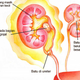 Illustration for article titled Gambar Orang Sakit Batu Ginjalem/em